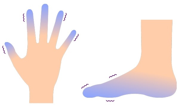 Raynauds sygdom